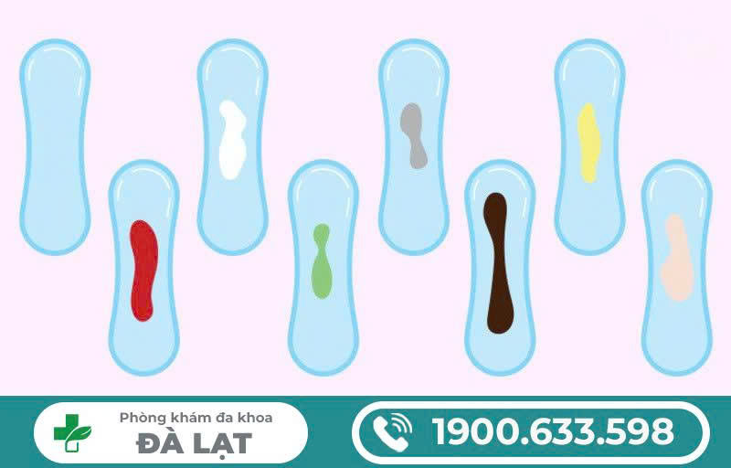 Hình ảnh minh họa